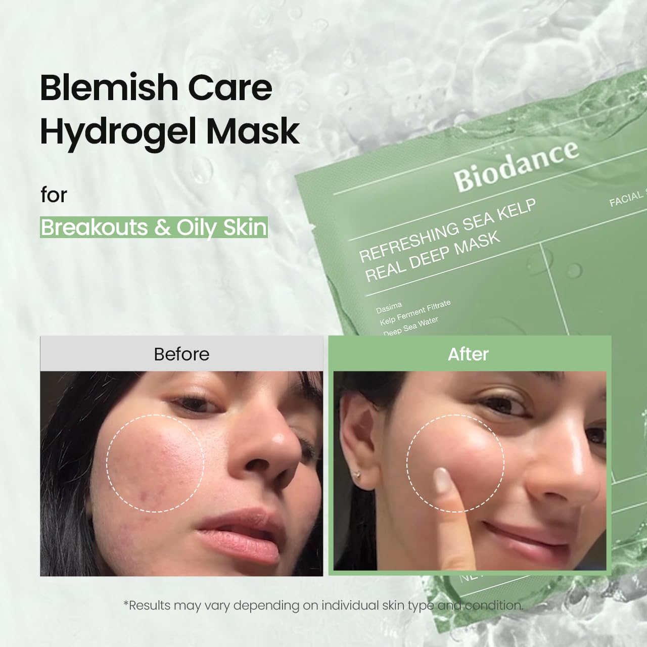 BIODANCE Bio-Collagen Masque Profond Réel, Masque Hydrogel, Minimisation des Pores, Amélioration de l'Élasticité, Skincare Coréenne| 34 g (1,19 oz) x 4 pièces