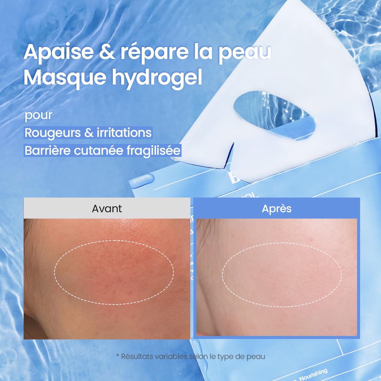 BIODANCE Bio-Collagen Masque Profond Réel, Masque Hydrogel, Minimisation des Pores, Amélioration de l'Élasticité, Skincare Coréenne| 34 g (1,19 oz) x 4 pièces